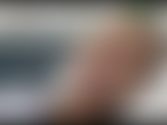 Can Myomectomy Improve Fertility Naturally?