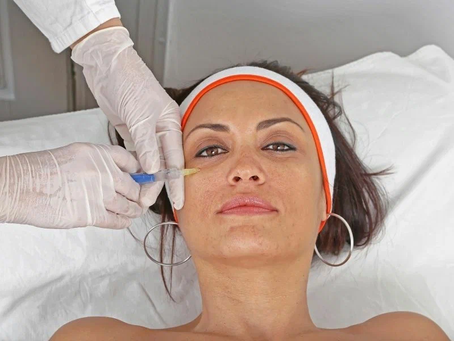 How Do Dermal Filler Injections Smooth Wrinkles Instantly?