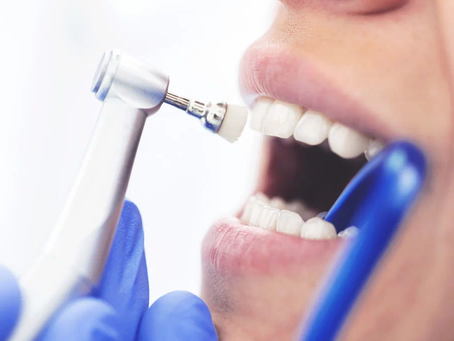 How does teeth cleaning enhance dental aesthetics?