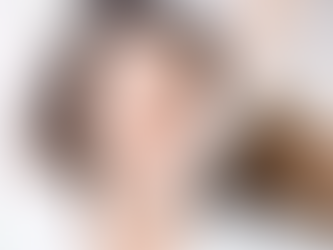 Is the 8 Point Facelift with Juvederm Safe?