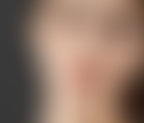 Can Non-Surgical Rhinoplasty Improve Your Nose Shape Fast?