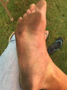 Just a bit dirty…was the only damage from the run home