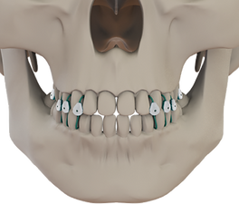 14 - minneties_image_technique_step_14_frontclosedtrimmed_edited.png