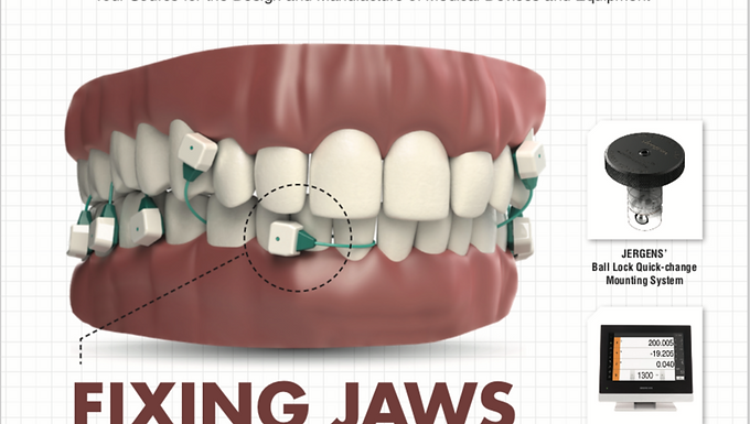 Today's Medical Developments: Fixing Jaws
