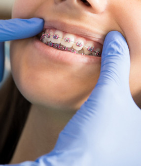 orthodontic-treatment-braces-oakleigh-de
