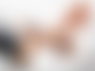 5 sintomas de colesterol alto que você deve ficar atento