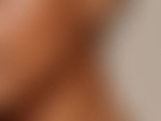 peau présentant des grains de beauté ou naevi