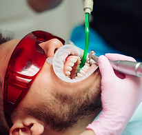 procedimiento de limpieza dental