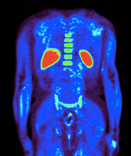 Screenshot 2015-04-03 10.11.11.png