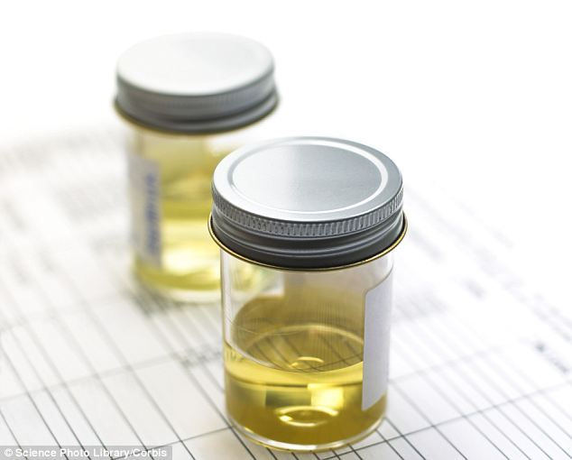 Urine test.jpg