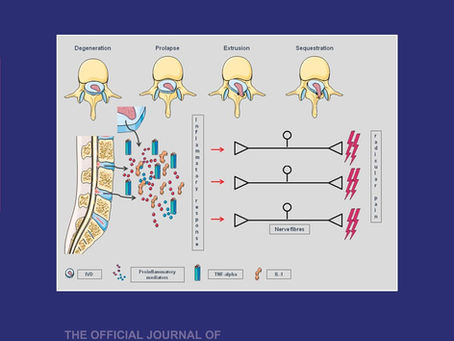 Eletroacupuntura para dor miofascial
