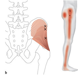 Fasciatherapie