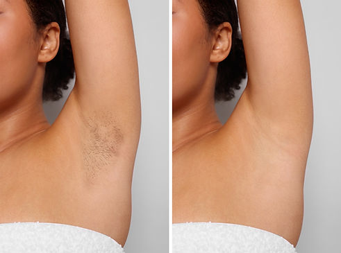 UNDERARM IPL_2639381061.jpg