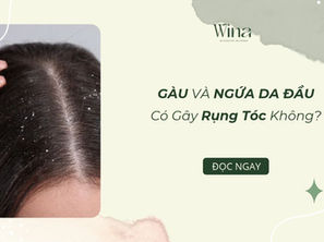 Gàu Và Ngứa Da Đầu Có Gây Rụng Tóc Không