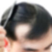 A healthy lifestyle plays an important role in protecting and improving hair health.
