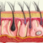 Ở phụ nữ, nồng độ Estrogen sụt giảm mạnh trong giai đoạn mãn kinh khiến hormone DHT (Dihydrotestosterone) chiếm ưu thế, làm nang tóc co lại