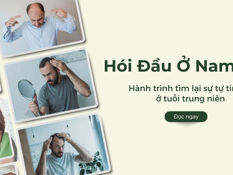 Vượt Qua Mặc Cảm Hói Đầu: Hành Trình Tìm Lại Sự Tự Tin Ở Tuổi Trung Niên
