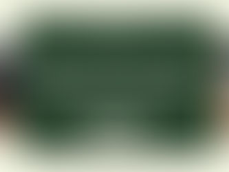 Rụng Tóc Sau Sinh Và Nỗi Lo Thưa Đỉnh Đầu: Khi Nào Nên Dùng Tóc Giả?