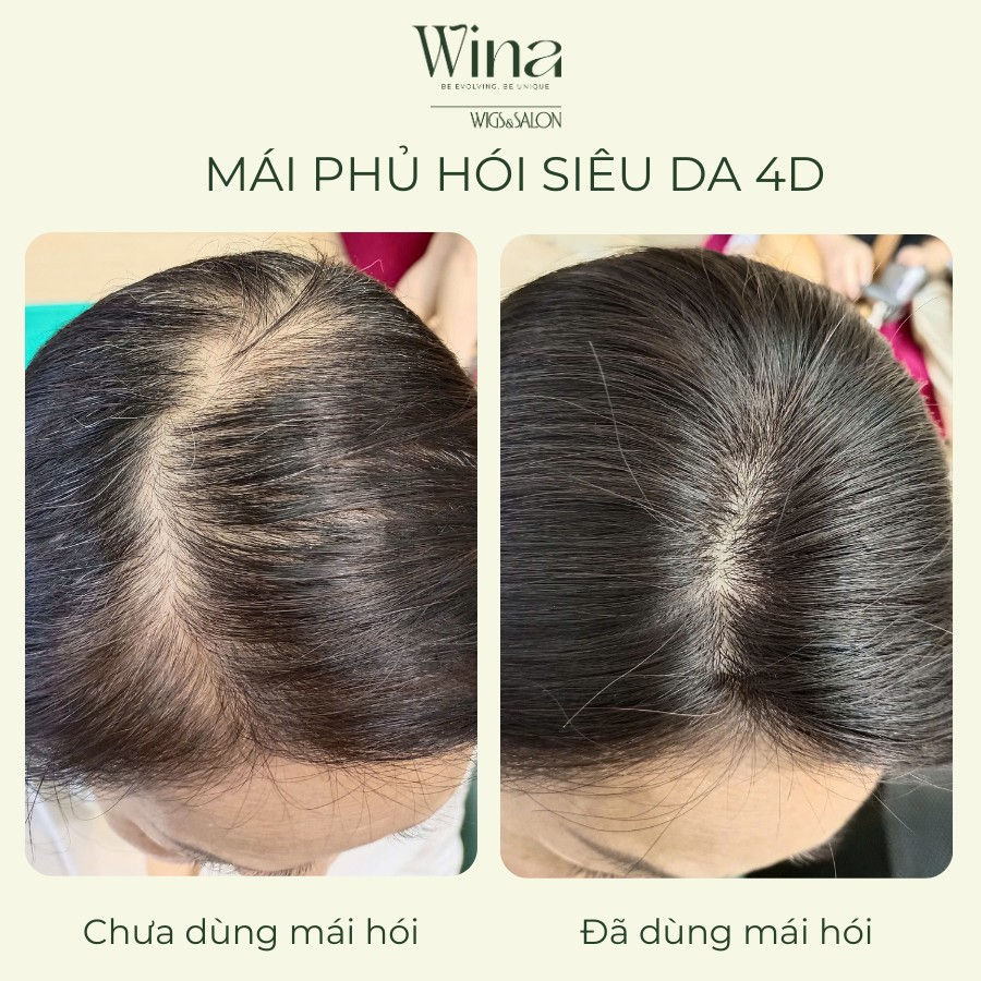 Tóc Giả Quận 5 – Cửa Hàng Bán Tóc Giả Bằng Tóc Thật Chất Lượng