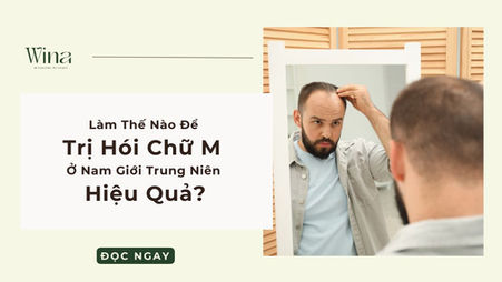 Làm Thế Nào Để Trị Hói Chữ M Ở Nam Giới Trung Niên Hiệu Quả?