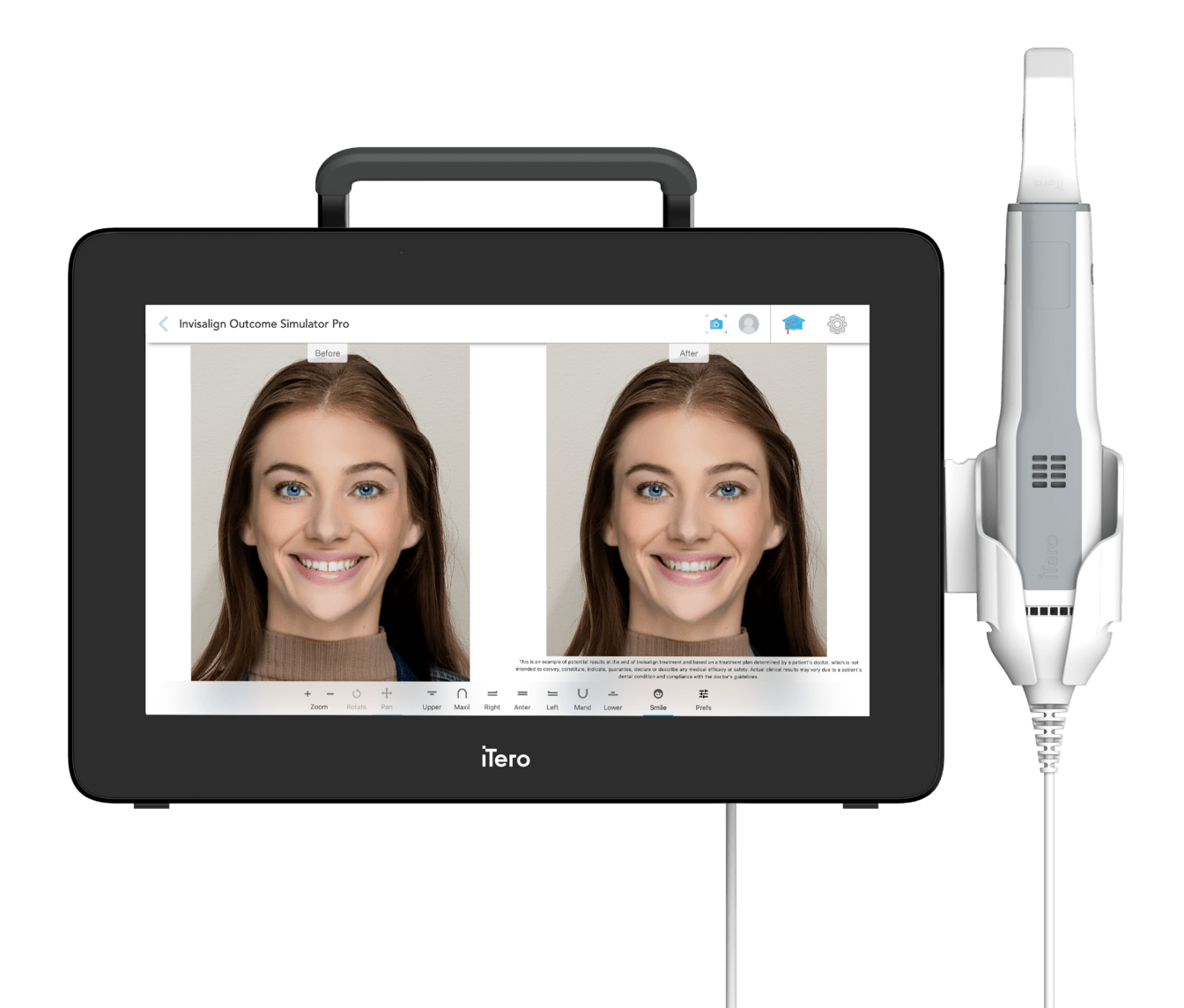 D’empreintes numériques 3D