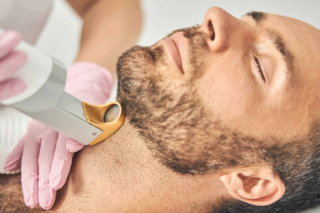 Épilation définitive au Laser