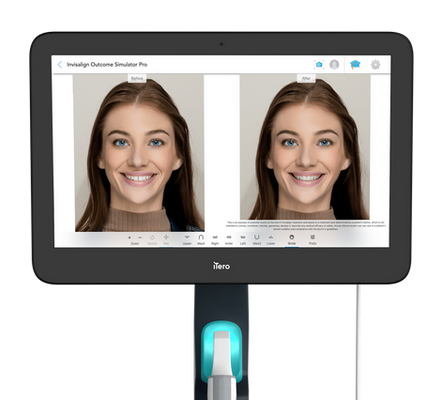 scan iTero Lumina™