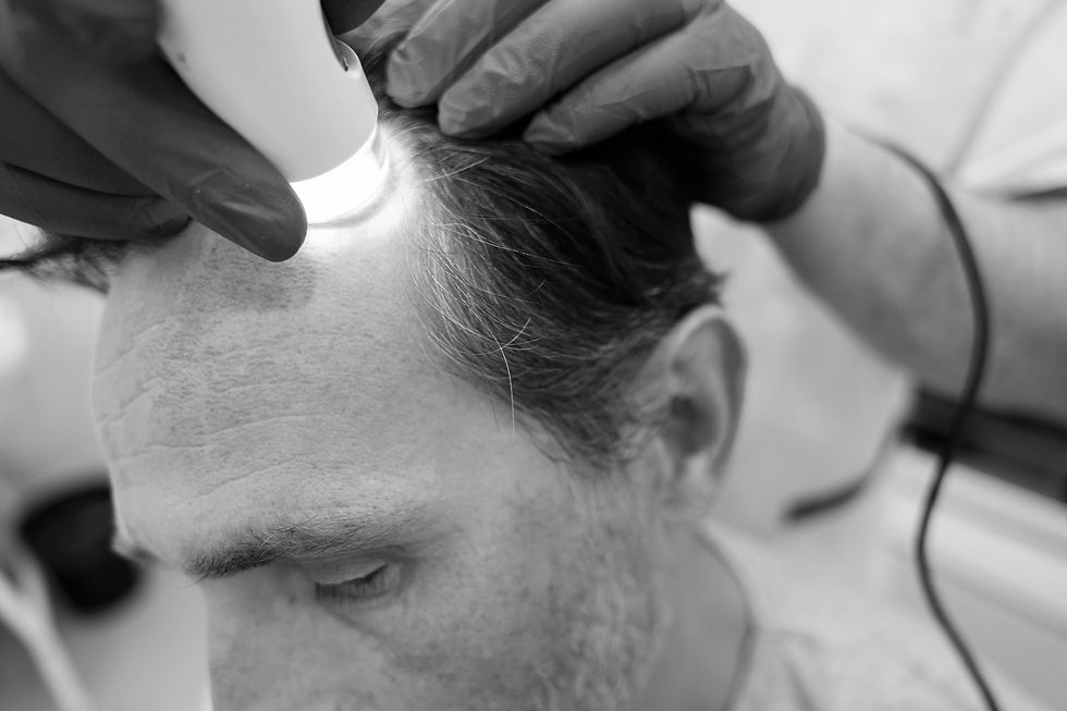 man-getting-hair-loss-treatmentpb.jpg