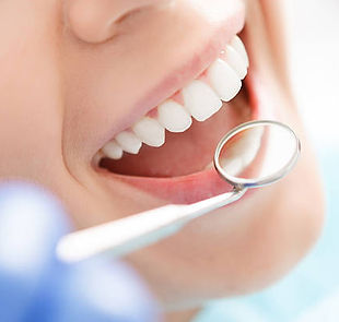 igiene dentale.jpg
