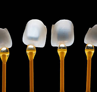 faccette dentali1.jpg