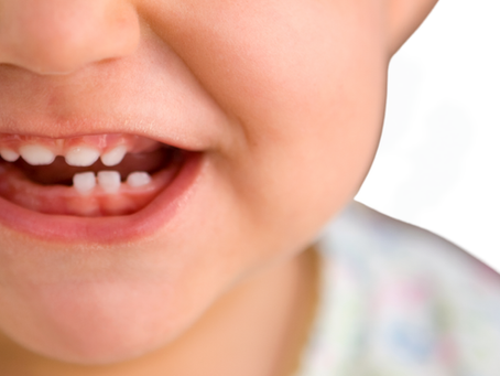 Denti da latte: tutto quello che devi sapere e quando effettuare la prima visita