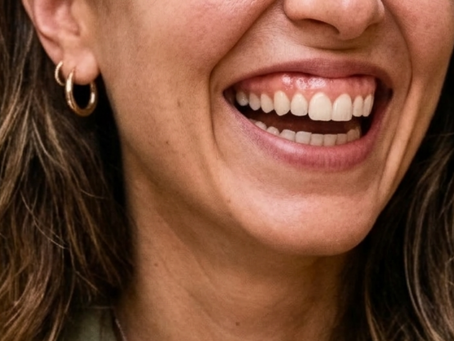 Gummy Smile: si corregge senza chirurgia? Le opzioni che non sapevi di avere