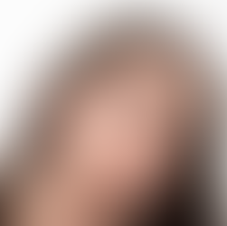 How to Reduce Dark Circles Under Eyes | Complete Guide