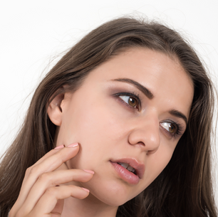 How to Reduce Dark Circles Under Eyes | Complete Guide