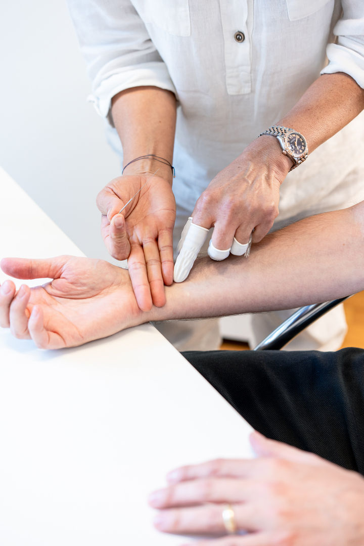 Close-up of Hui Zhang preparing to place acupuncture needle in a patient’s arm while palpating the pulse for precise diagnosis.