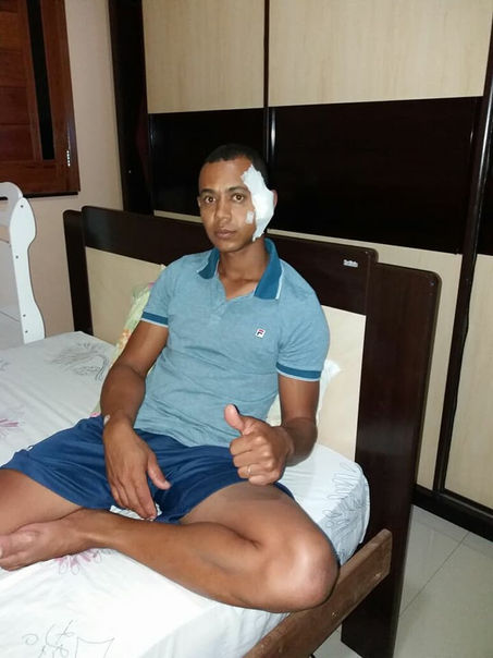 Cirurgia é um sucesso e goleiro Au se recupera em casa