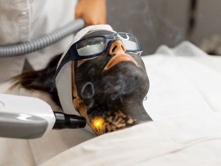 🌿 Carbon Peel Facial in Altrincham