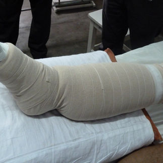lymphoedema bandages
