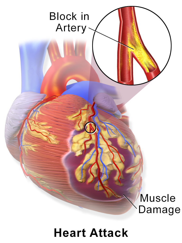 EXSCEL exenatide cardiovascular outcomes | DietApp.com GLP1 Tracker
