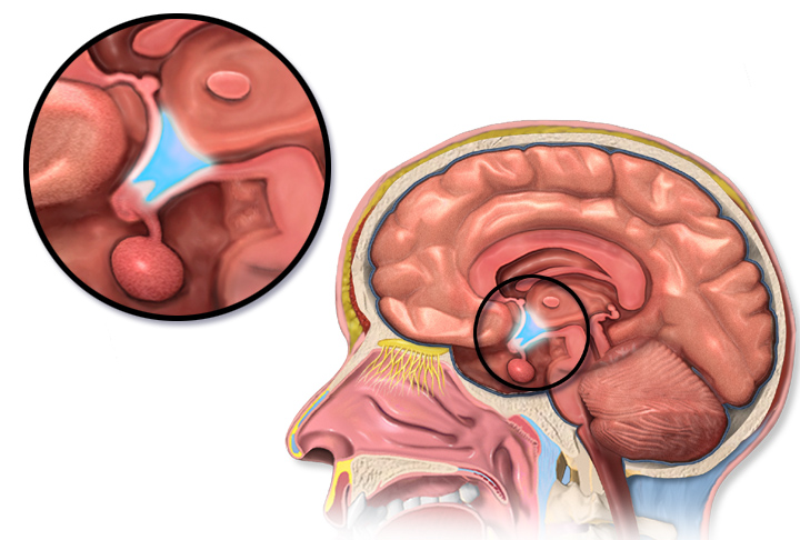 Amycretin GLP1 amylin hypothalamus appetite mechanism | DietApp.com GLP1 Tracker