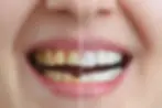 cosmetic dentistry img (3)
