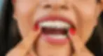 invisalign aligners img 1
