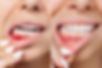 periodontist.jpg