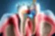 root canal treatment 3