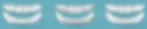 smile makeover.webp