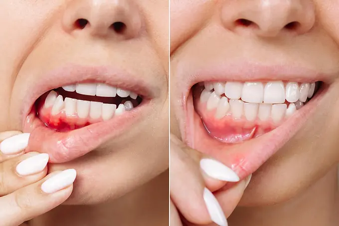 periodontist.webp