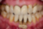 periodontics
