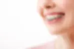 braces