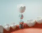 Dental Implants (1)