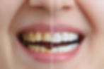 cosmetic dentistry img (3)